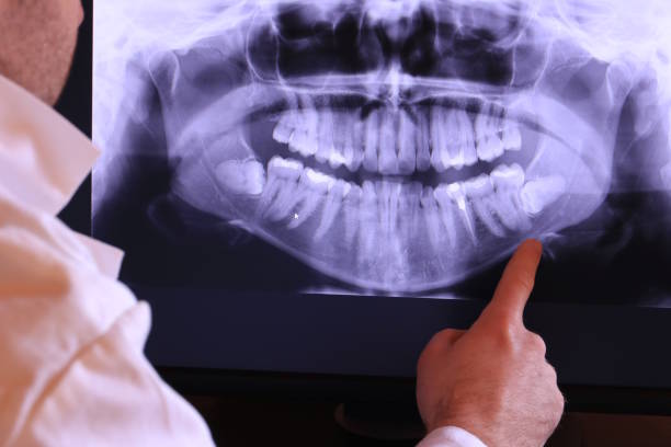 Emergency Dentist for Kids in MI
